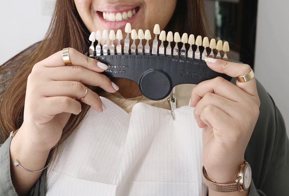 Get Instant White Teeth at The Smile Bar PH